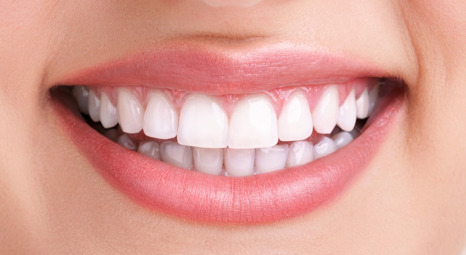 Close-up of a bright, even smile after cosmetic treatment