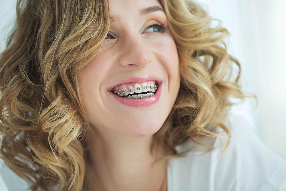 A woman laughing while wearing orthodontic braces