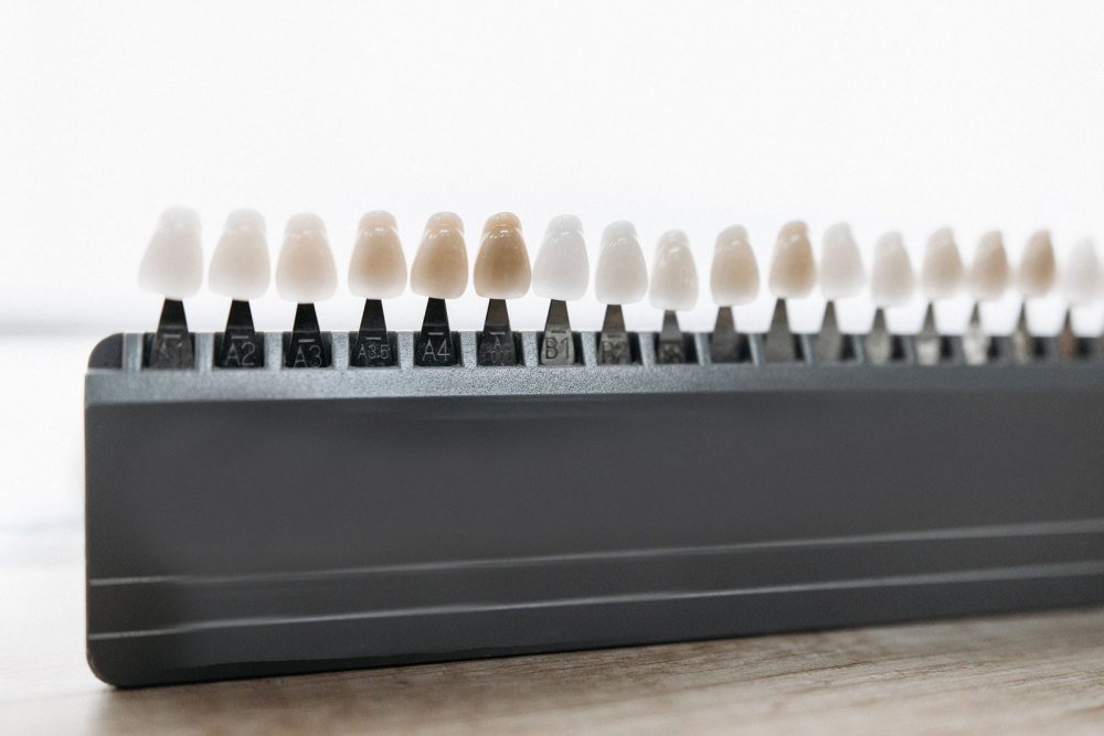 A row of porcelain tooth shade samples, from bright white to warmer tones, lined up on a dark grey holder